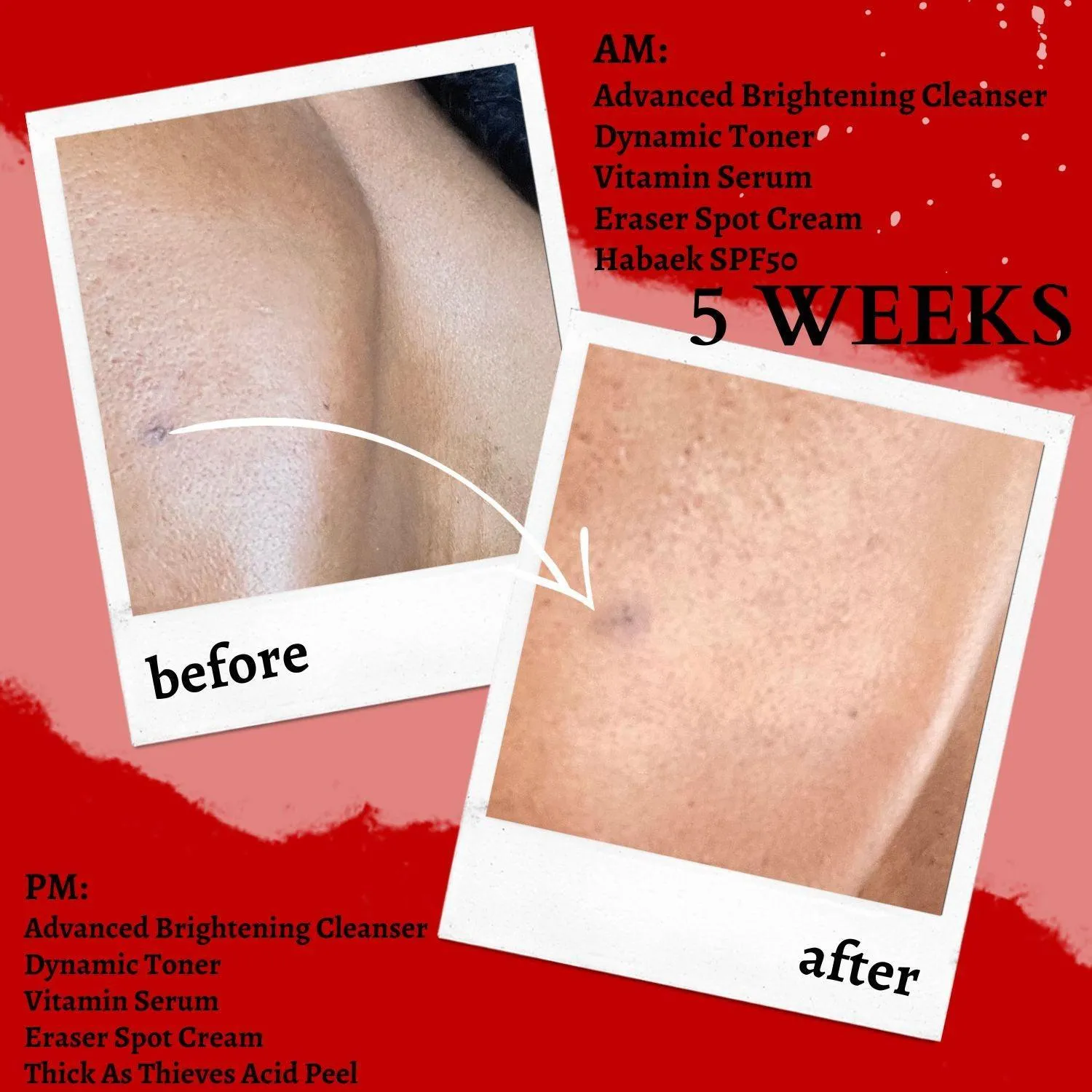 Dynamic Toner