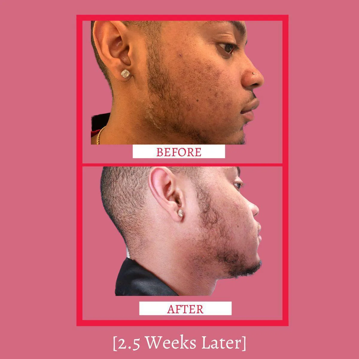 Dynamic Toner