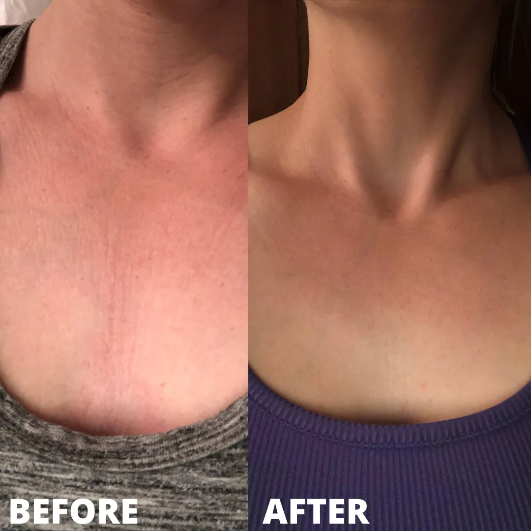 Glycolic Peel Cleansing Pads with Salicylic Acid