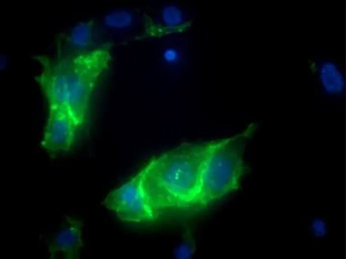 Primary Human Coronary Artery Endothelial Cells (ACBRI 377)