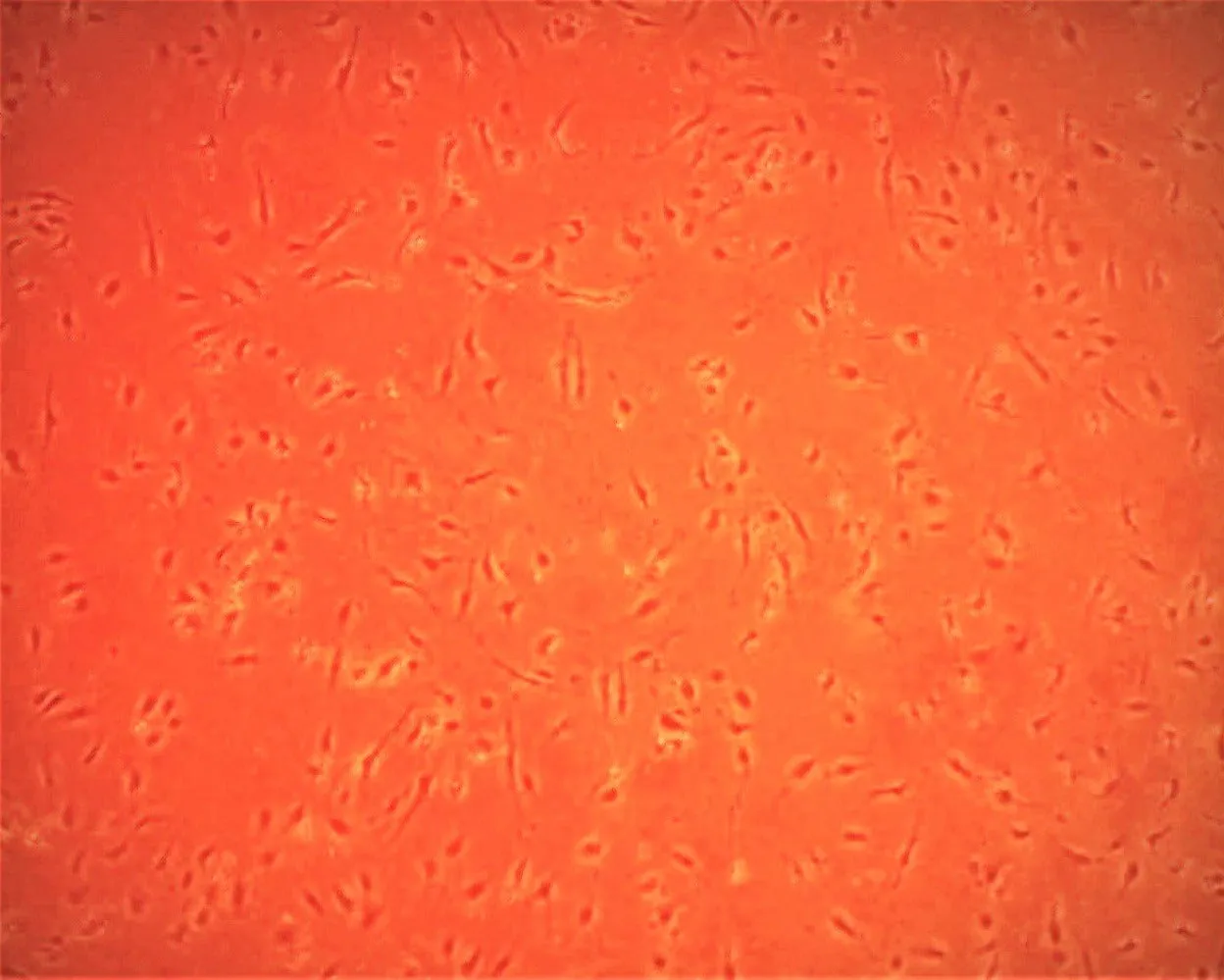 Primary Human Coronary Artery Endothelial Cells (ACBRI 377)