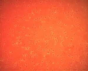 Primary Human Coronary Artery Endothelial Cells (ACBRI 377)