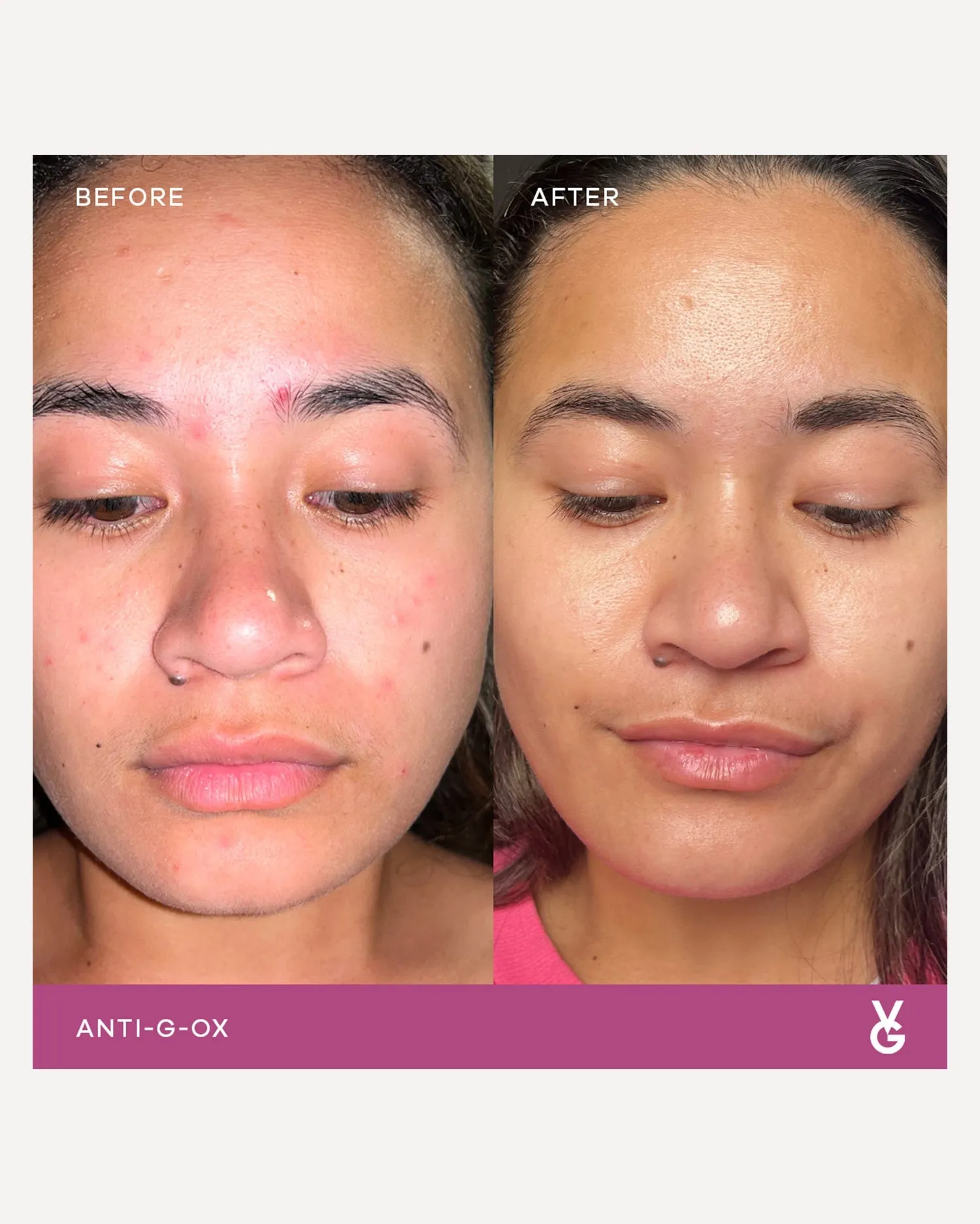 Vida Glow Anti-G-Ox Mixed Trial Pack